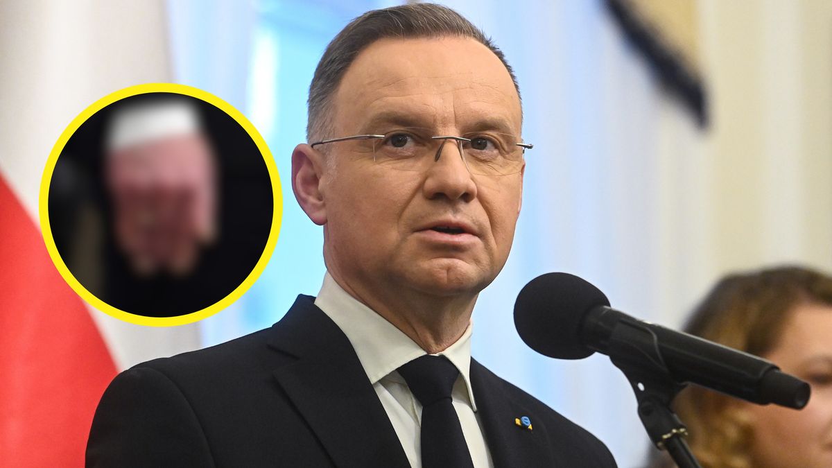 Koszmarna kontuzja prezydenta Andrzeja Duda