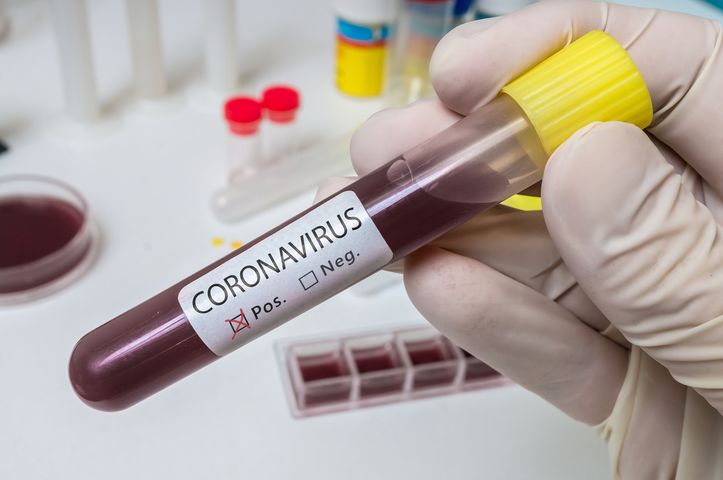 Koronawirus w Polsce. Dlaczego lepiej nie robić testu, kiedy nie ma objawów? Wyjaśnia dr Ernest Kuchar 
