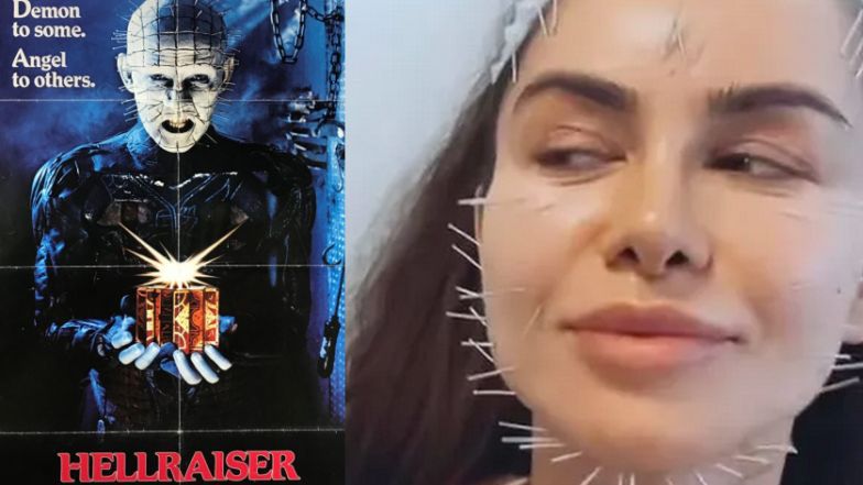 Natalia Siwiec relacjonuje wizytę w klinice medycyny estetycznej