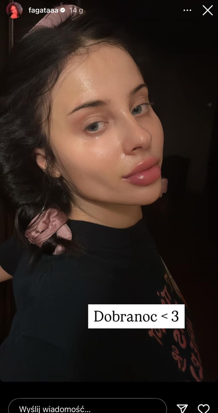 Naturalna Fagata Prezentuje Swoje Lico Bez Grama Makija u Tu Przed 
