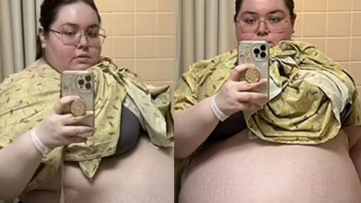 Szok! 20-latka z Florydy miała to w brzuchu!  