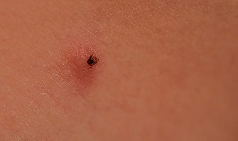 Kleszcz wyglądał jak czarna kropka