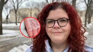 Rok po operacji zauważyła coś w głowie. Lekarz to zignorował