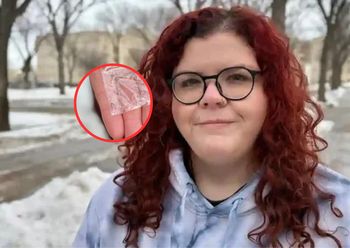 Rok po operacji zauważyła coś w głowie. Lekarz to zignorował