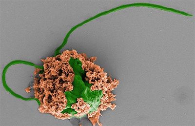 Mikrobot zwalczający zapalenie płuc (na zielono) pokryty biodegradowalnymi nanocząsteczkami polimerowymi (na brązowo).