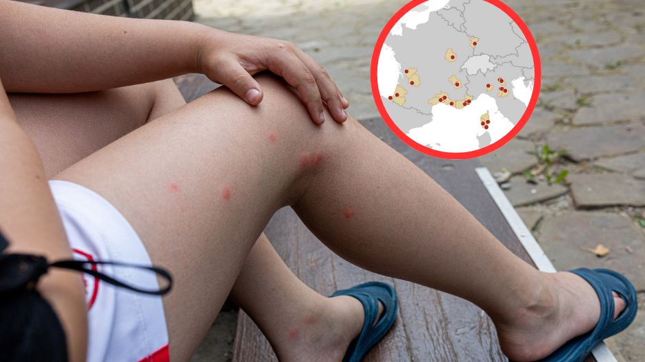 Wirus chikungunya. ECDC ostrzega przed komarami