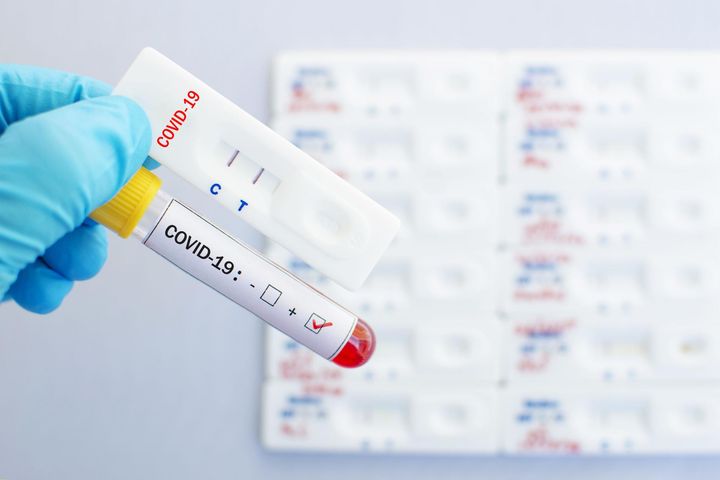 Na ten moment w Polsce i na świecie istnieje kilka różnych testów na koronawirusa