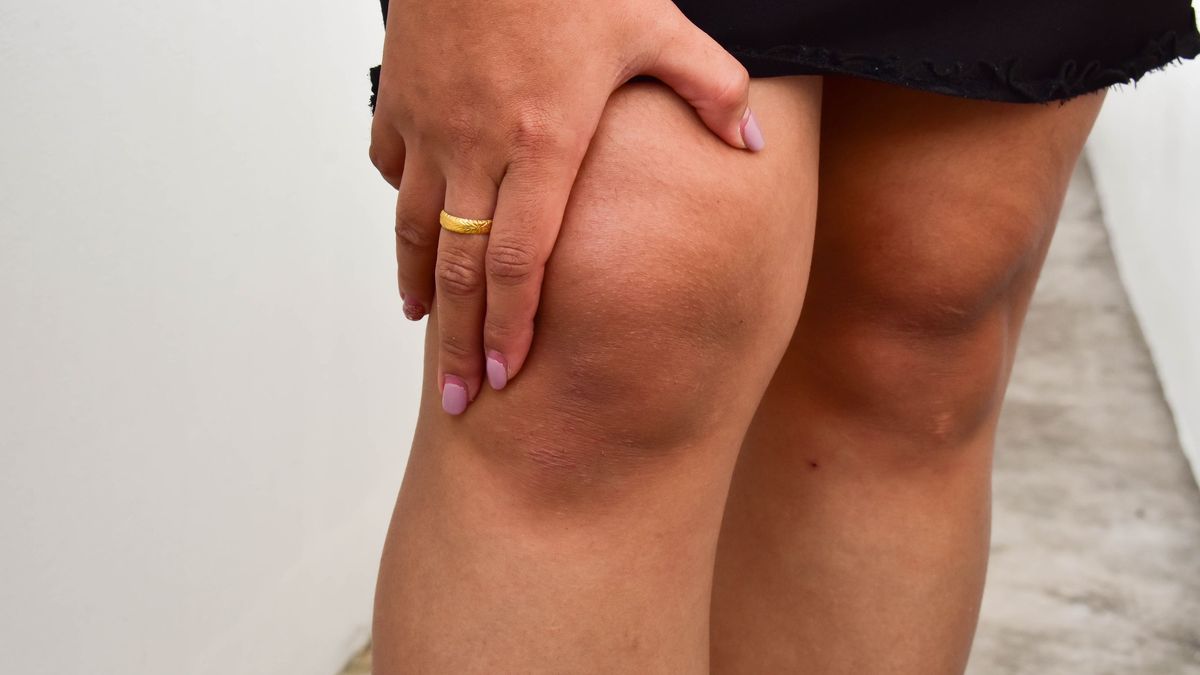 Strzelanie w kolanach