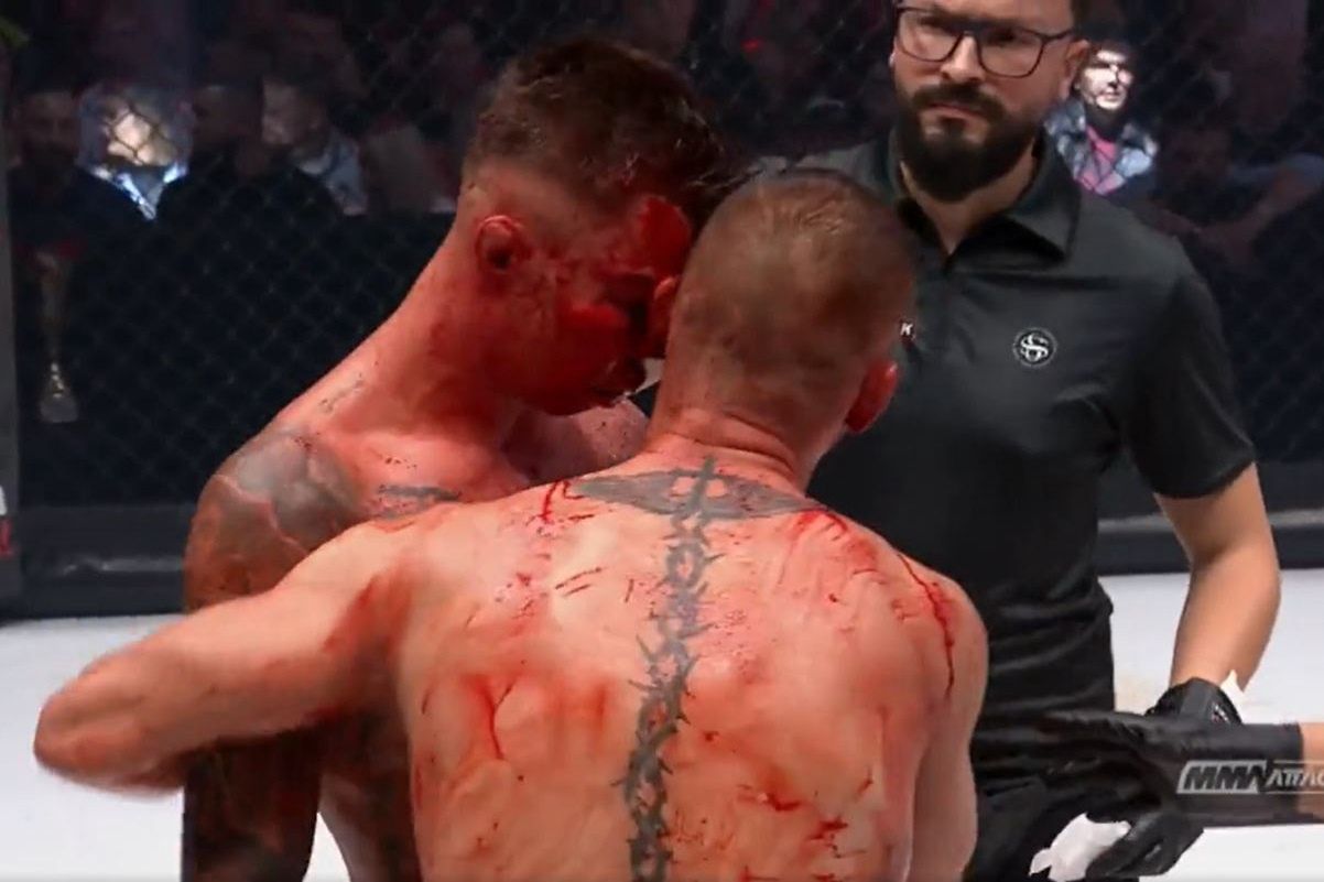 Tak wyglądali po walce MMA. Zdjęcie tylko dla ludzi o mocnych nerwach