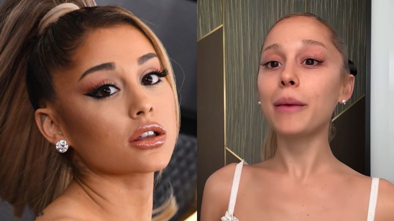 Ariana Grande ZREZYGNOWAŁA z wypełniaczy i botoksu, mając 25 lat. "Po prostu czułam się tak… To było za dużo"