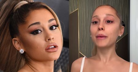 Ariana Grande ZREZYGNOWAŁA z wypełniaczy i botoksu, mając 25 lat. "Po prostu czułam się tak… To było za dużo"