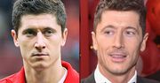 Robert Lewandowski miał operację plastyczną? Krzysztof Gojdź odpowiada