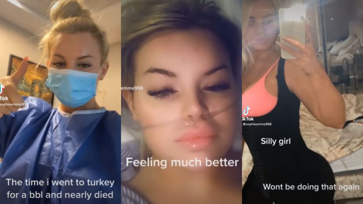 Tiktokerka wybrała się do Turcji na BBL. To, co przeżyła potem, to prawdziwy koszmar