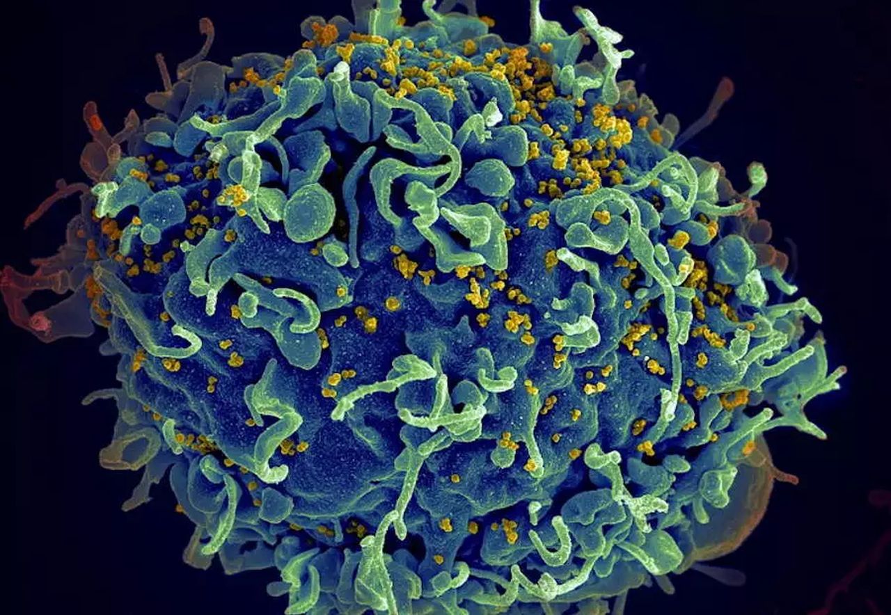 Jak wywabić wirusa HIV z komórek? Naukowcy znaleźli sposób
