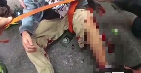 Ocaliła życie 4-latki. Teraz policjantka zbiera pieniądze na jej leczenie