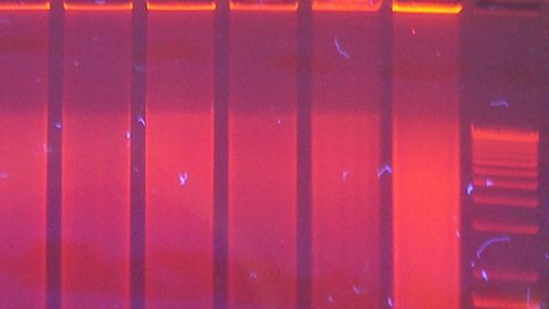 Osobisty lek na raka dzięki superczułemu laserowi 1