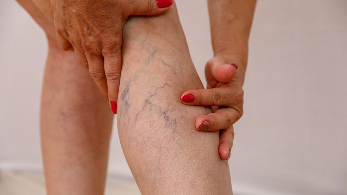 Żyły są ważnym elementem układu krwionośnego