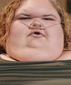 "Siostry wielkiej wagi". Cieszy się, że żyje. Tyle zrzuciła w walce o zdrowie