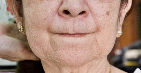 Działa jak plaster. W aptece kupisz za kilka złotych