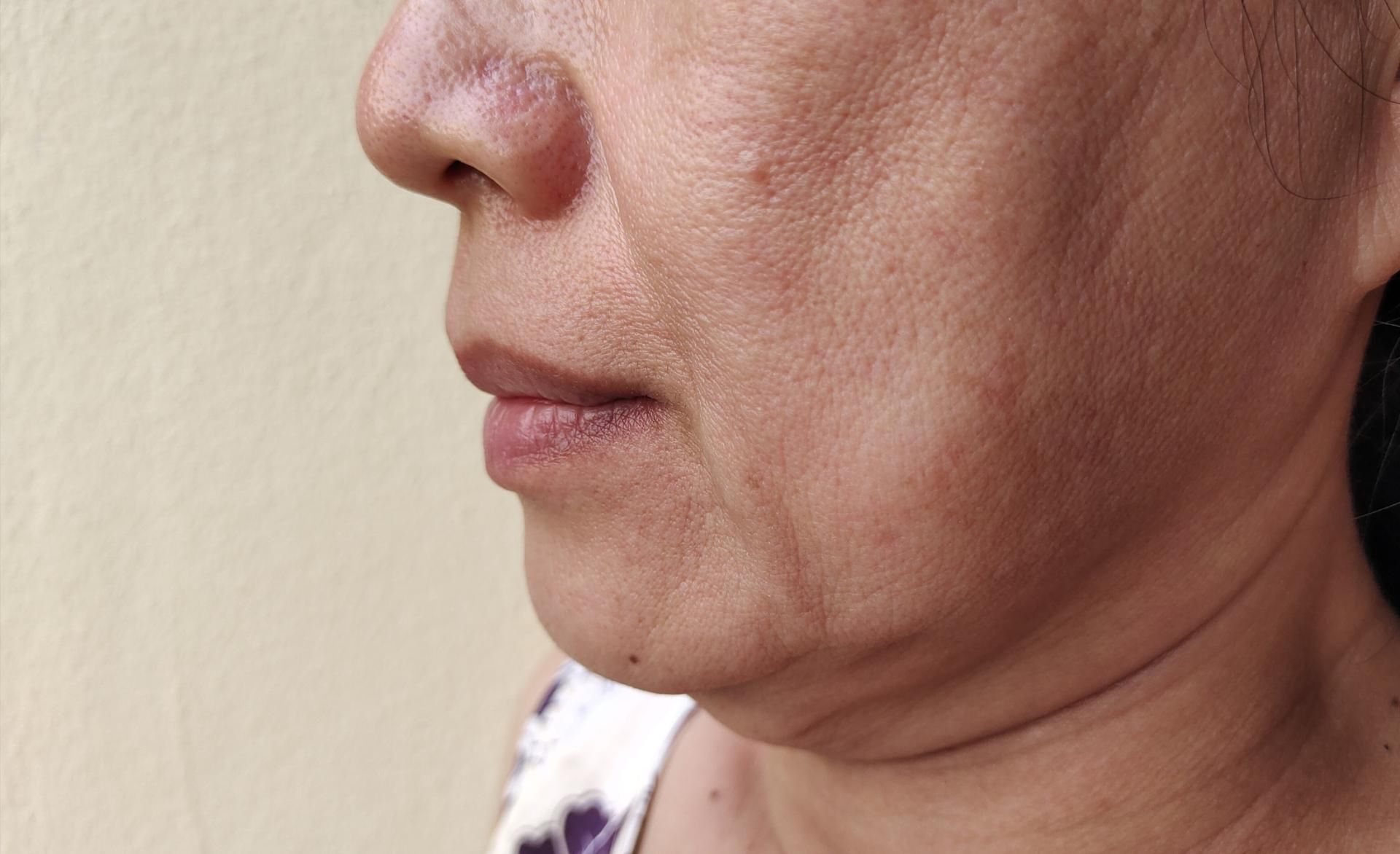 Objawy poważnych chorób można zauważyć na twarzy