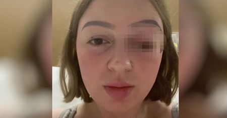 Podczas porodu tak mocno parła, że zrobił jej się wytrzeszcz. "Kolejny powód, by nie zajść w ciążę"