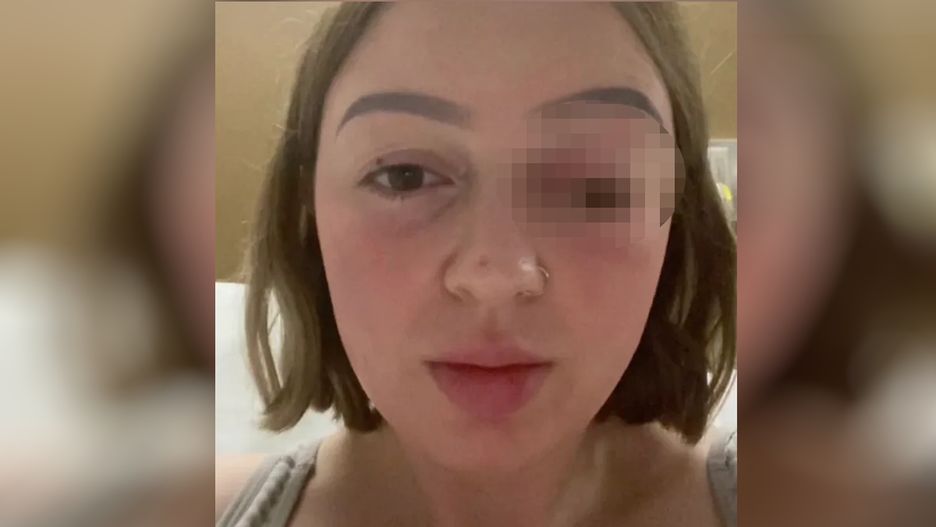 Podczas porodu tak mocno parła, że zrobił jej się wytrzeszcz. "Kolejny powód, by nie zajść w ciążę"