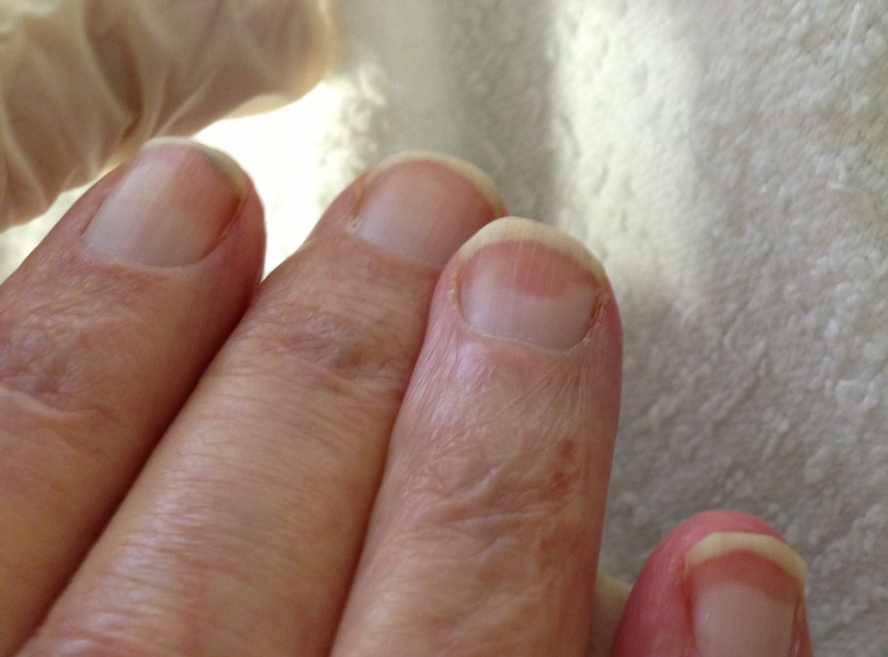 Zauważyłeś na paznokciach? Twoje serce i wątroba mogą "wołać" o pomoc