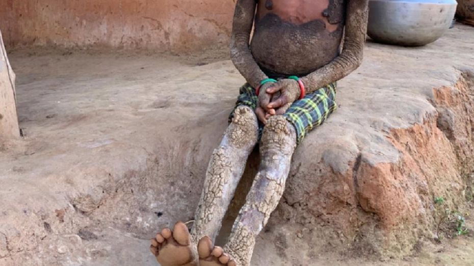 Zamienia się w kamień