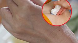 Pojawia się na skórze. Tak daje o sobie znać rak jelita grubego