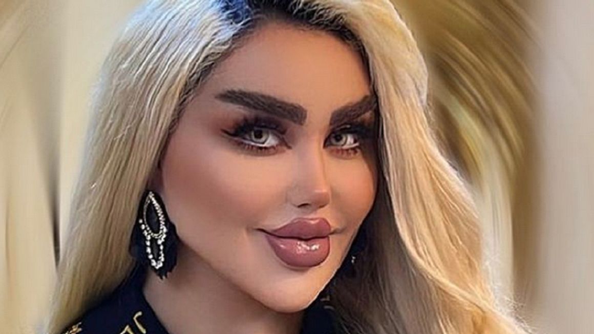 Dalia przeszła wiele operacji żeby wyglądać jak Barbie.