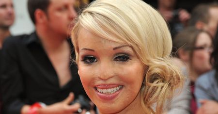 Przeszła ponad 200 operacji. Dziś wygląda zupełnie inaczej