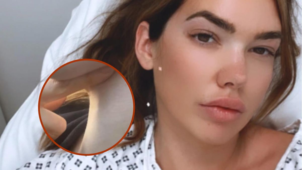 Alix Burnard ostrzega przed uporczywym kaszlem, który może być objawem raka płuc