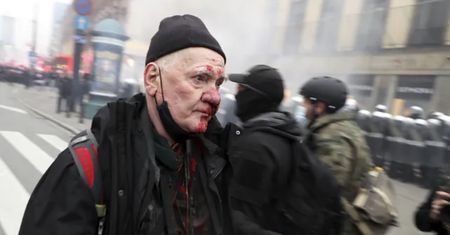 Tomasz Gutry. Poszkodowany fotoreporter wyszedł ze szpitala