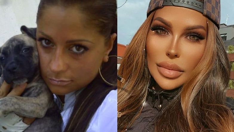 Gwiazdy, które zrobiły sobie nos