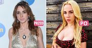 Poprawiła urodę, bo nie zrobiła kariery w "Top Model"? Schreiber przedstawiła DŁUGĄ listę zabiegów, jakie przeszła