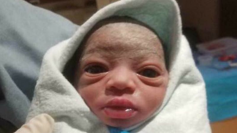 Chce oddać dziecko, bo... jest "brzydkie"