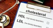 Cholesterol po 50. roku życia. Uważaj na te błędy. Mogą poważnie pogorszyć stan twojego zdrowia