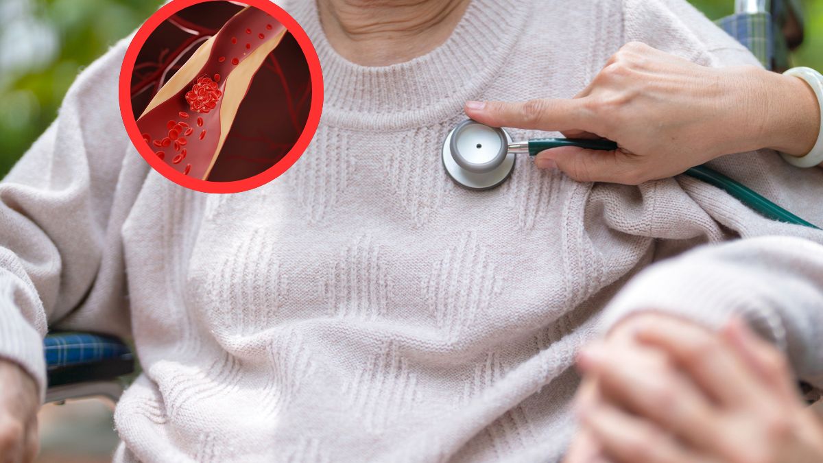 Nowe wytyczne odnośnie poziomu cholesterolu