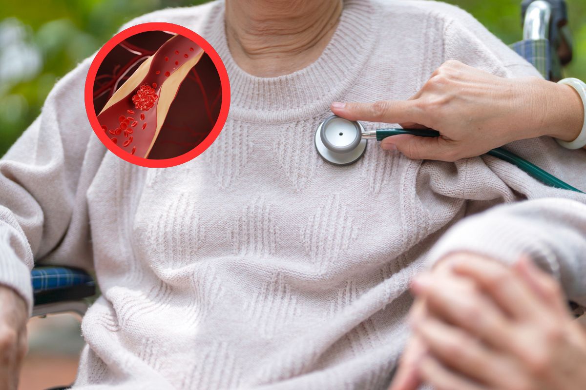 W USA nowe wytyczne. Zaostrzyli progi dla cholesterolu