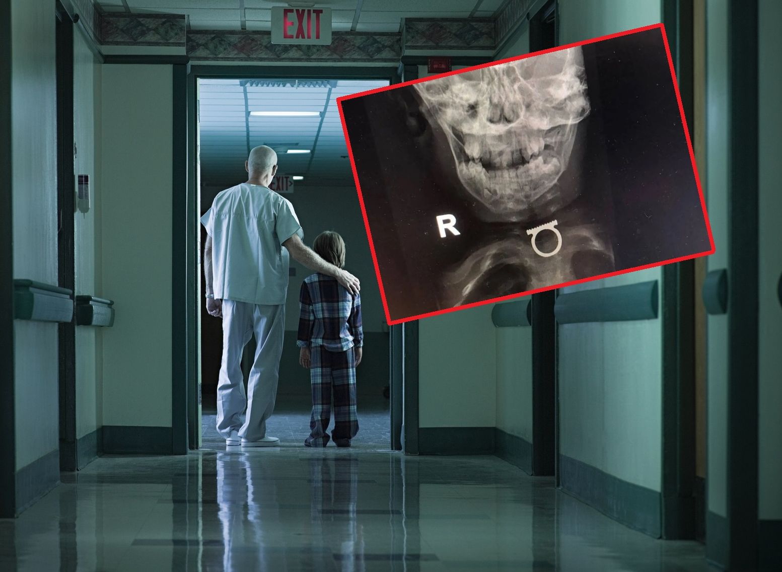 Jerozolima: Trzylatek połknął pierścionek 