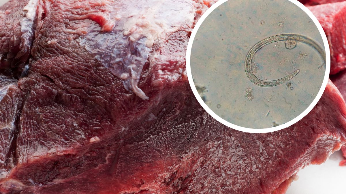 W mięsie znaleźć można liczne pasożyty