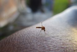 Domowe sposoby na ugryzienia komarów. Szybko złagodzisz swędzenie