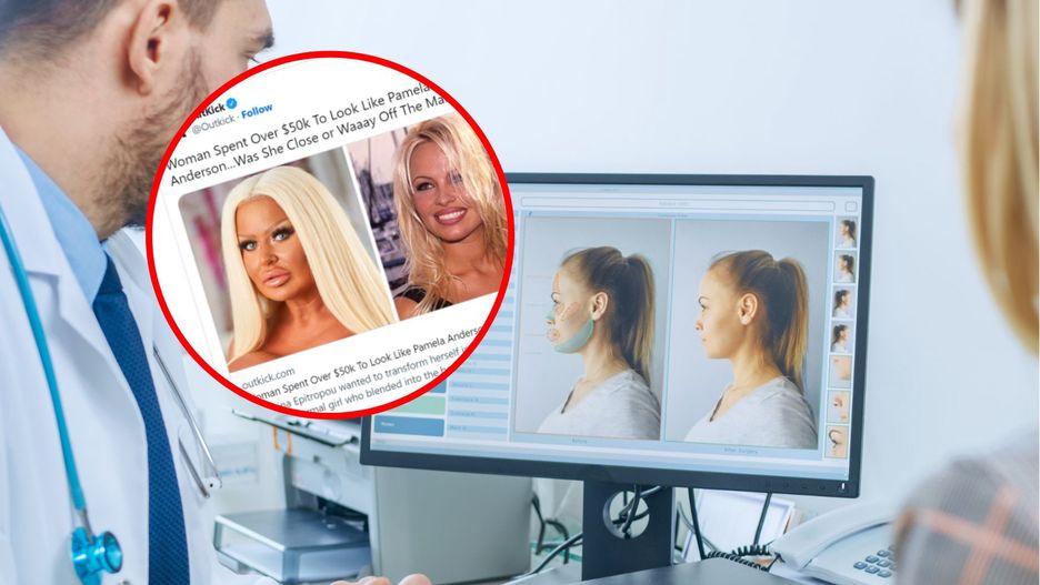 Obywatelka Wielkiej Brytanii wydała prawie 250 tysięcy, aby wyglądać jak Pamela Anderson