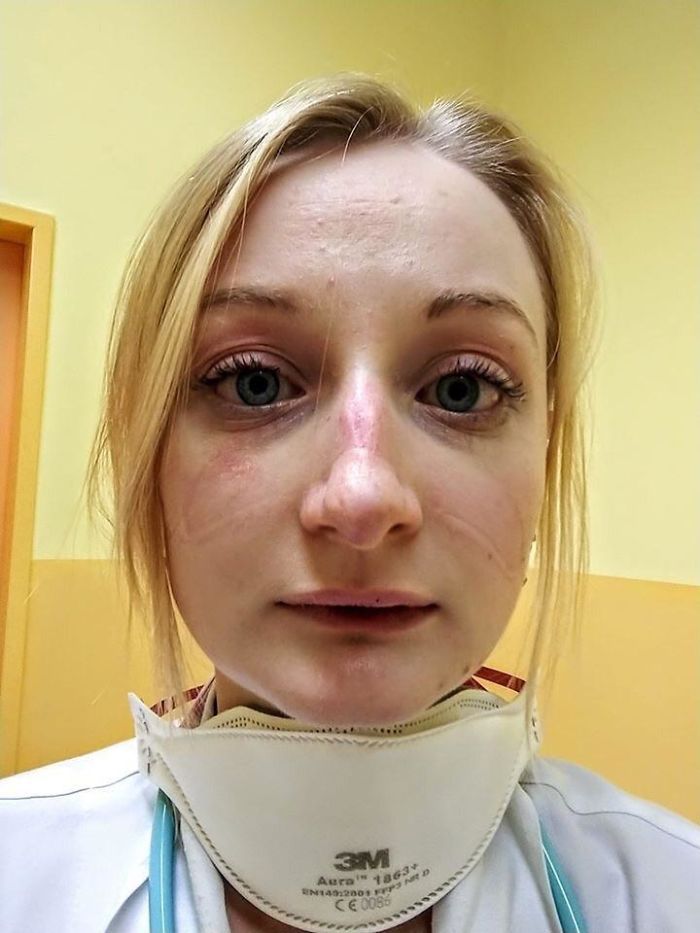 Lekarze i pielęgniarki po dyżurach. Te selfie pokazują twarze prawdziwych bohaterów 4