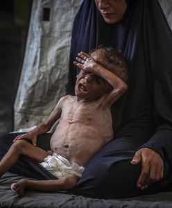 Ludobójstwo w Gazie. Dramatyczny komunikat. Zmarli z głodu