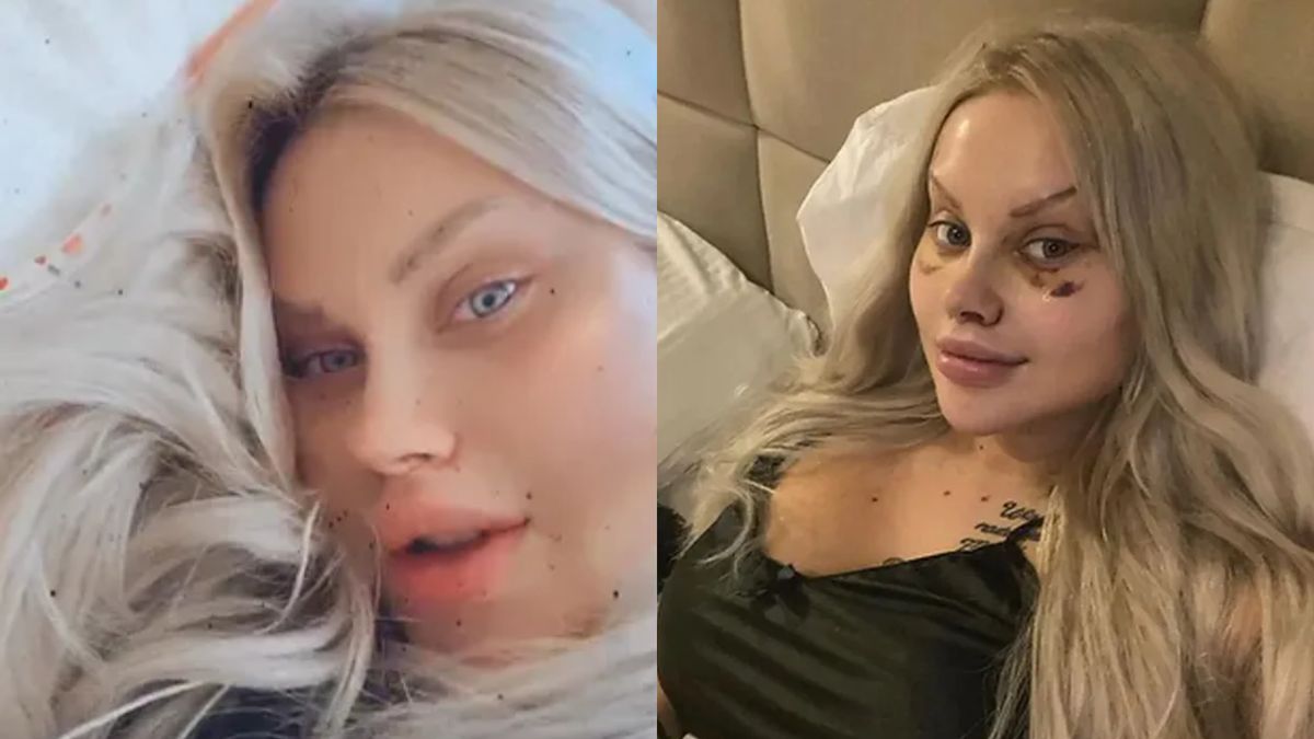 Ewel0na przyznaje, że trafiła do szpitala właśnie przez "upiększanie" w Turcji