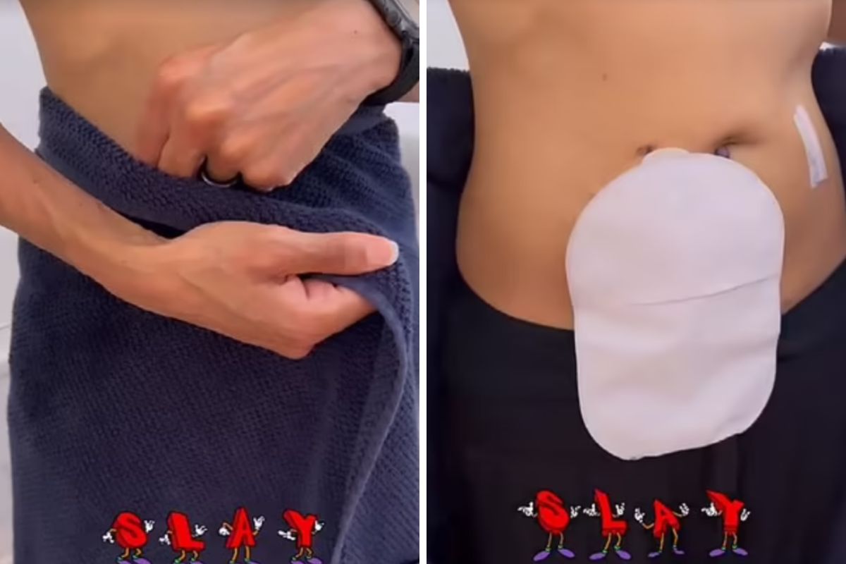 Prezenterka radiowa podchodzi do choroby i stomii z dystansem