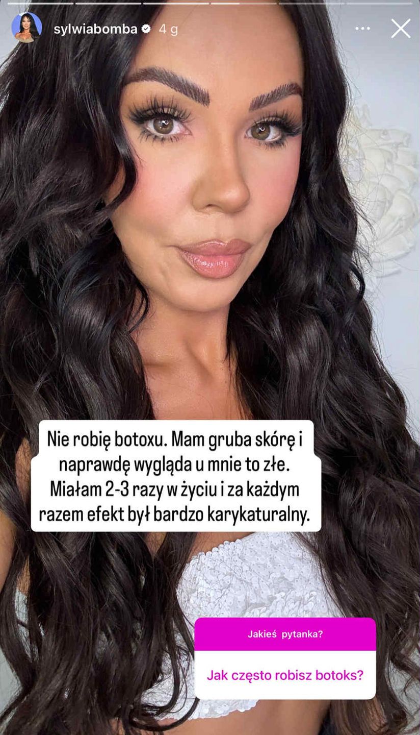Sylwia Bomba zmierzyła się z pytaniem o stosowanie botoksu