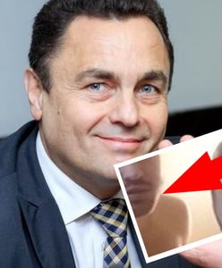 Wpadka konserwatywnego posła. Kamera pokazała półnagiego mężczyznę