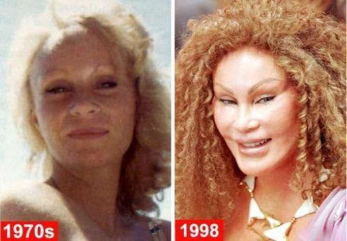 Jocelyn Wildenstein